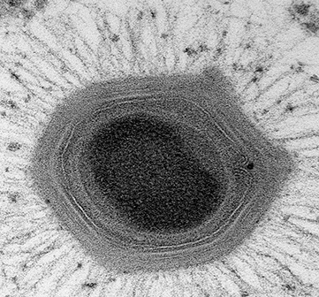 Mimivirus – een reus in een kleine wereld.