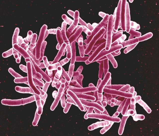 Comment la tuberculose échappe à notre réponse immunitaire