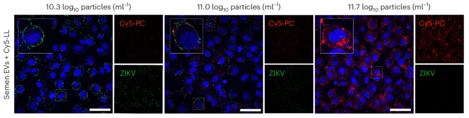 Moving from left to right, the authors added more and more hybrid, fluorescent EVs (here called particles) isolated from semen. The more EVs they added, the less viruses (ZIKV, green) could bind to the surface of the cell. Image source: Groß et al. Nature Microbiology 2024 
