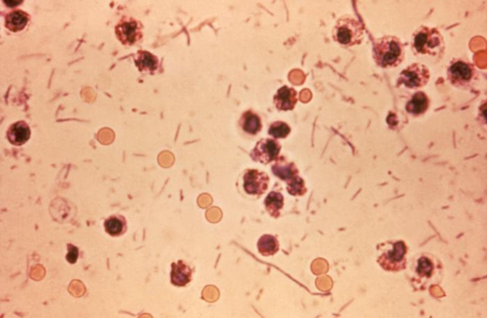 HD5: The Secret Trick of Shigella&nbsp;Infection