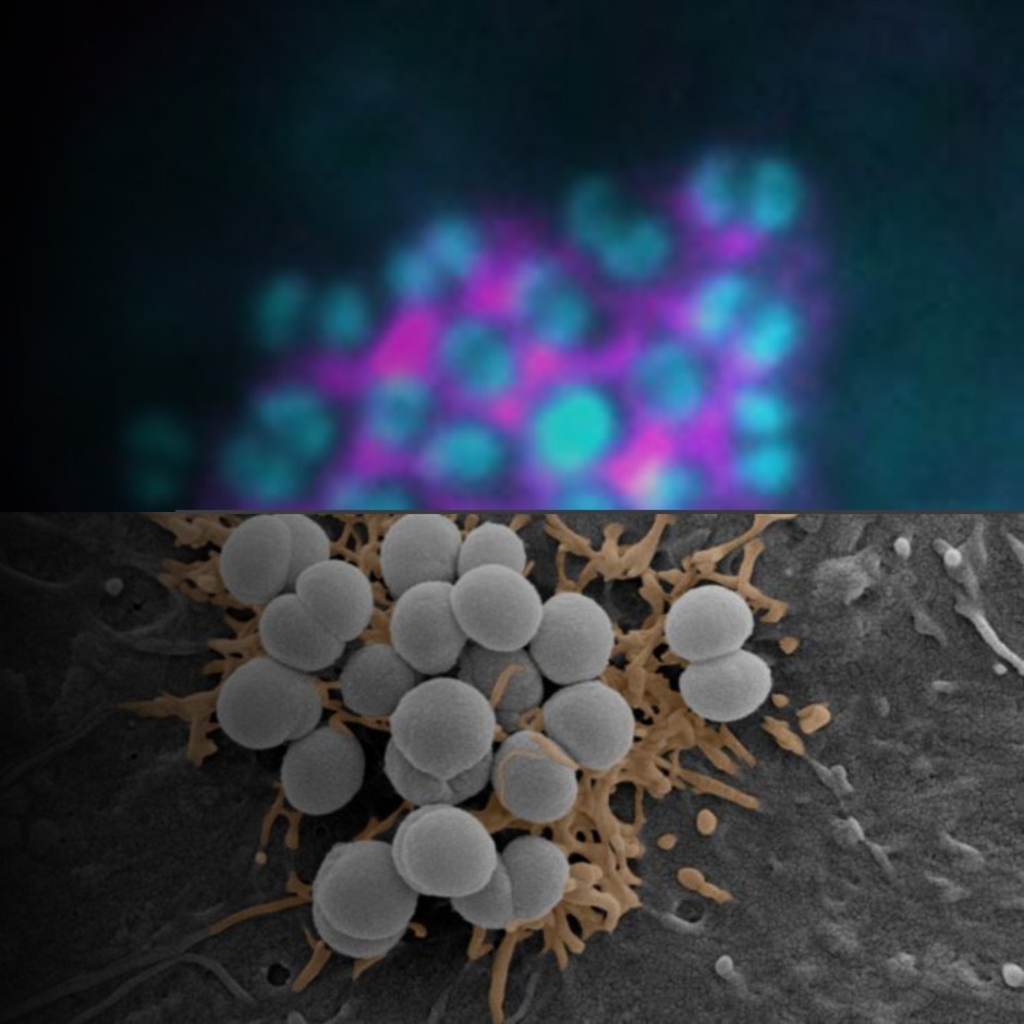 Les bact&eacute;ries manipulent nos cellules gr&acirc;ce &agrave; la&nbsp;physique