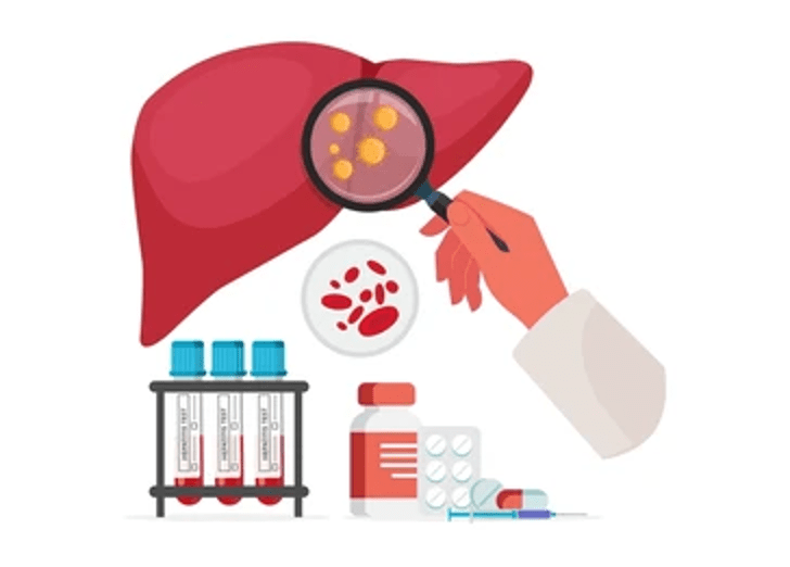 HBV Diagnosis through a&nbsp;Fingerprick