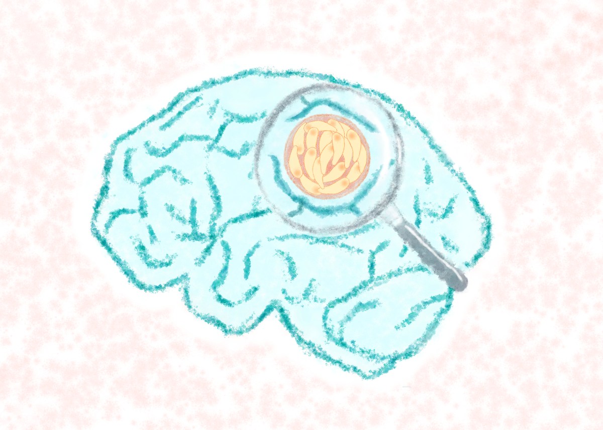 Toxoplasma gondii Parasites Do Not Just Hide in the&nbsp;Brain