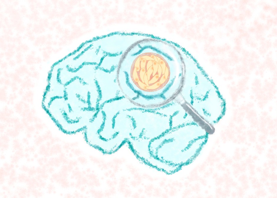 Toxoplasma gondii Parasites Do Not Just Hide in the&nbsp;Brain